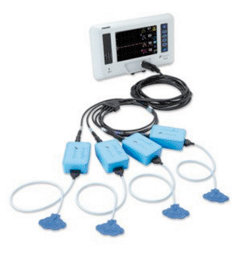 Imagen: El sensor Equamox Advance Model 8004CB Series (Fotografía cortesía de Nonin Medical). Imagen: El sensor Equamox Advance Model 8004CB Series (Fotografía cortesía de Nonin Medical).